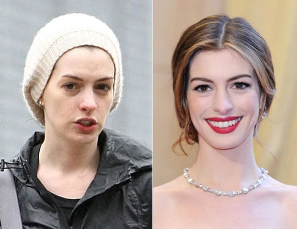 Celebridades-internacionais-sem-maquiagem-2-anne-hathaway