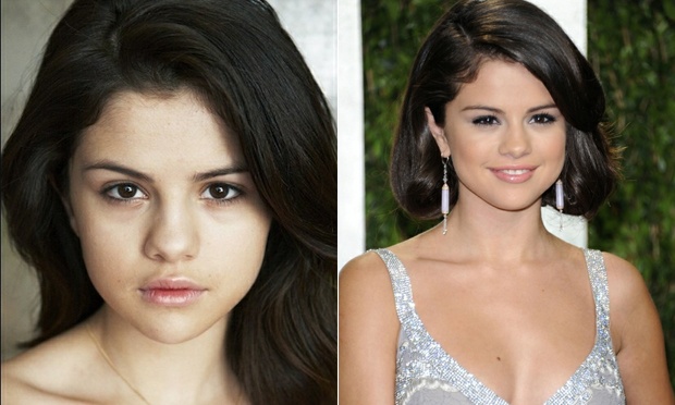 celebridades-internacionais-sem-maquiagem-24-Selena-Gomez